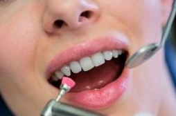 Профессиональная гигиена зубов