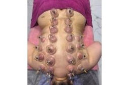 Баночный массаж