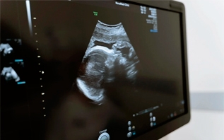 В Беларуси впервые провели уникальную операцию ребенку в утробе матери